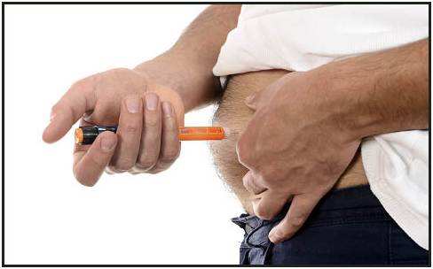 与皮下注射相比，胰岛素泵治疗二型糖尿病效果更好
