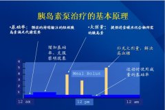 胰岛素泵国内生产厂家有哪些？