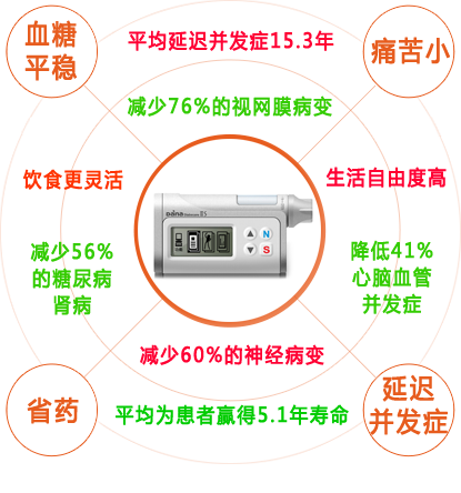 丹纳胰岛素泵治疗优势