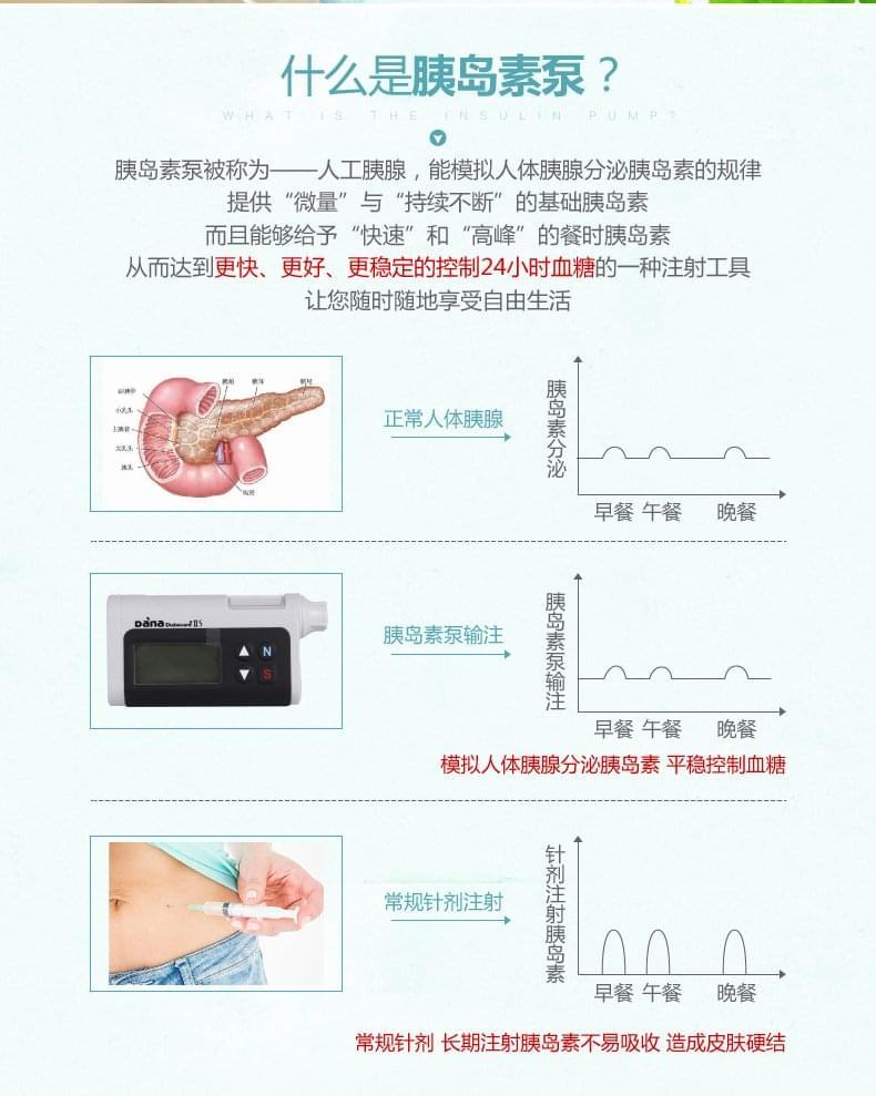 丹纳胰岛素泵介绍