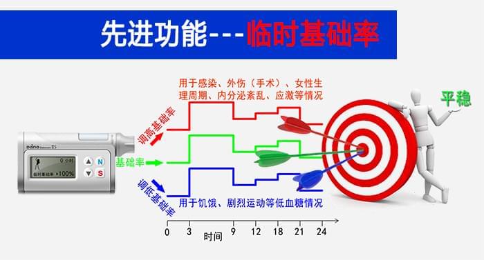 丹纳胰岛素泵的优势介绍