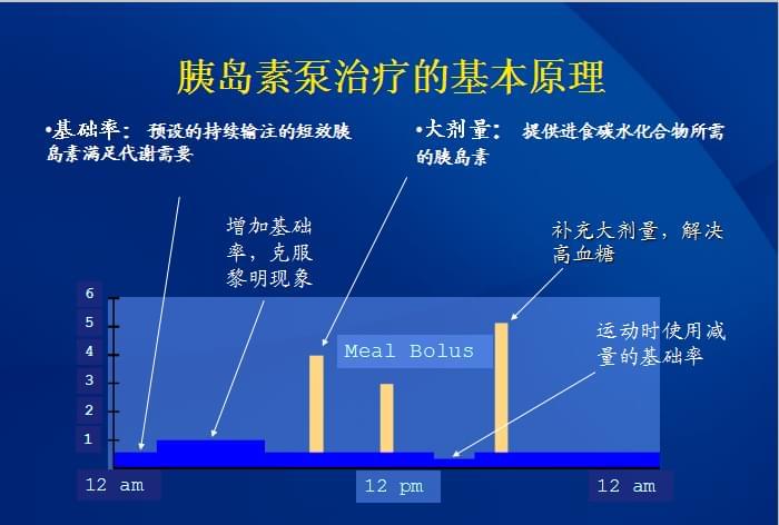 胰岛素泵功能