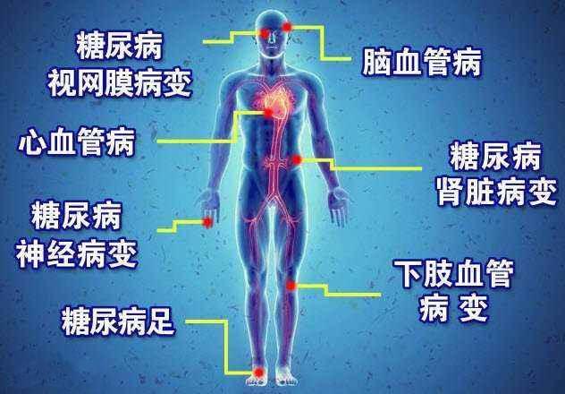 常见糖尿病并发症有哪些