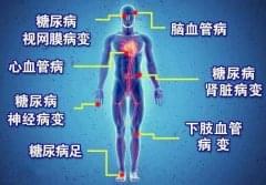 糖尿病患者如何才能增加寿命？