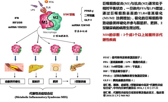 “胰岛巨噬细胞”有可能够促进糖尿病前期胰岛素的产生