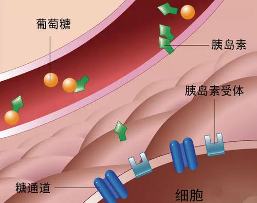 “胰岛巨噬细胞”有可能够促进糖尿病前期胰岛素的产生