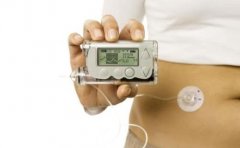 胰岛素泵治疗优势有哪些？